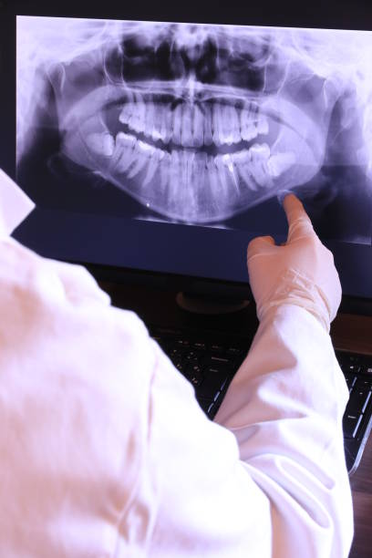 Best Emergency Dental Surgery in Wilsons Mills, NC